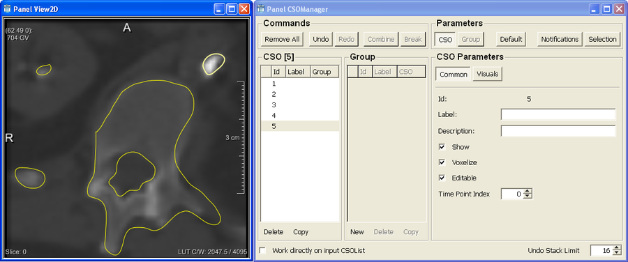 Freehand Contours with the SoView2CSOEditor Example Network