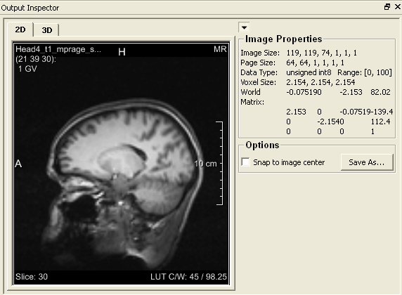 Image Properties for a Sagittal Image