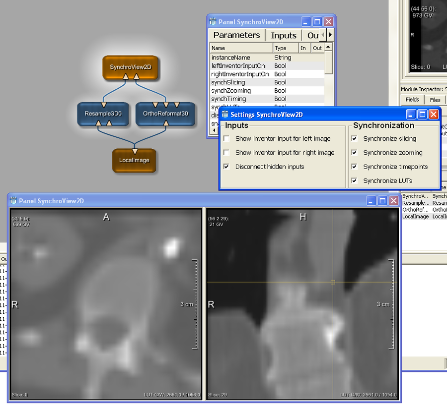 Example Network for SynchroView2D with Viewer (Panel), Automatic Panel and Settings